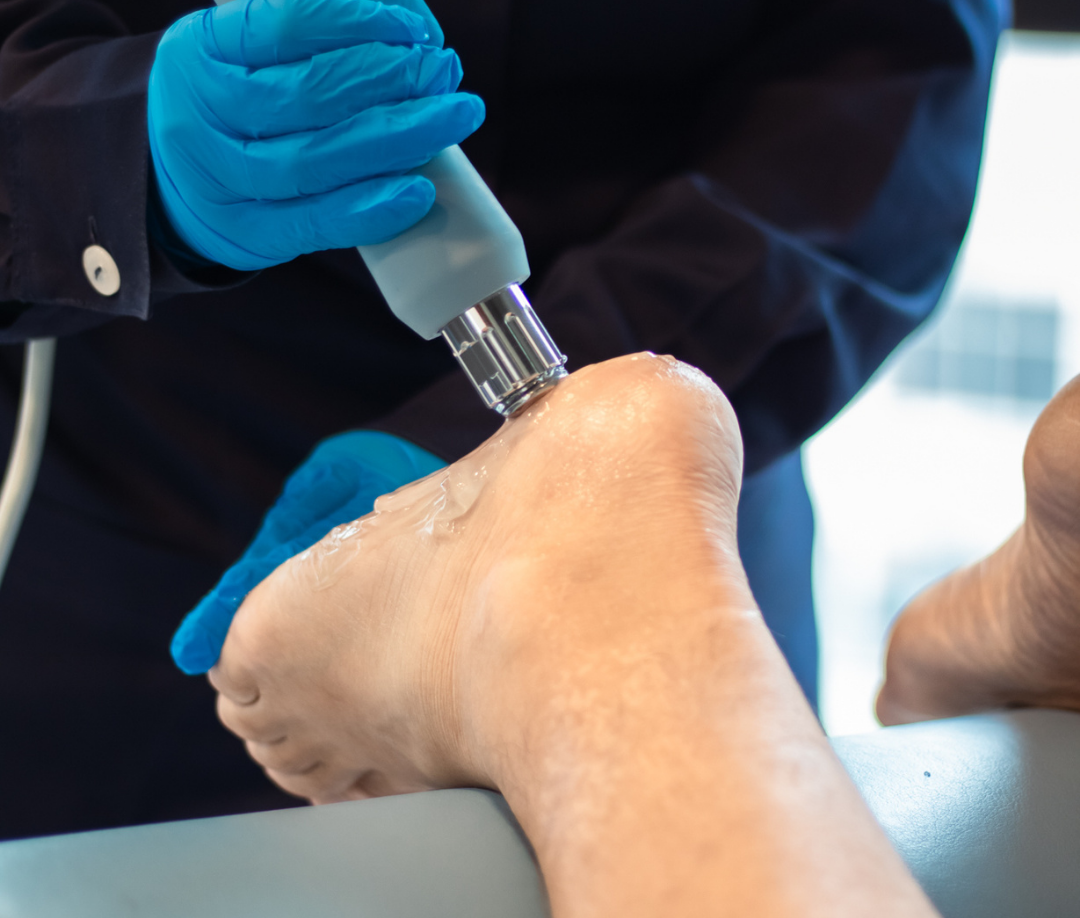 Aplicação de terapia por ondas de choque na FisioTropos